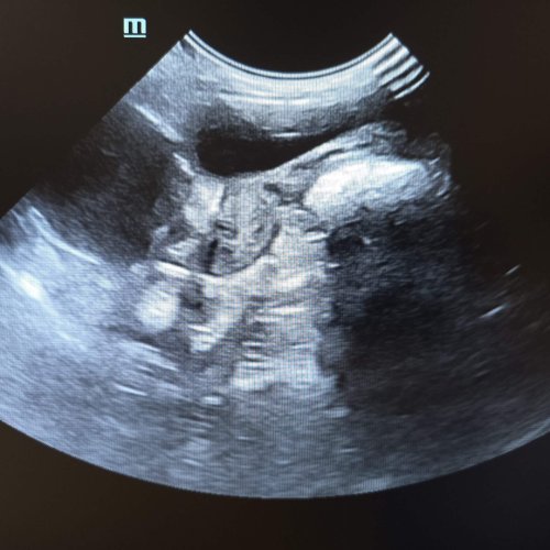 Pyometra