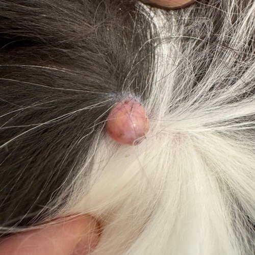 Skin Tag