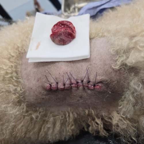 Lump Removal