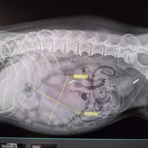 Mass in Abdomen
