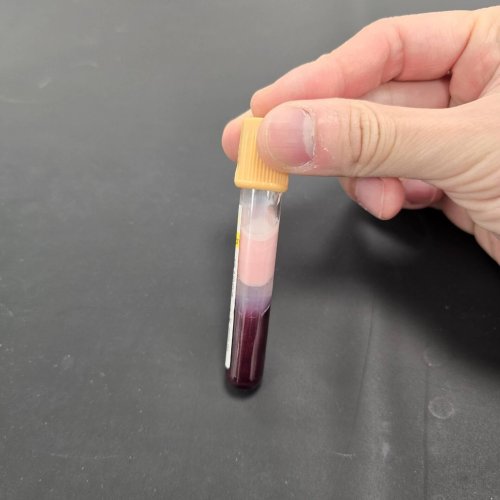 Blood Test